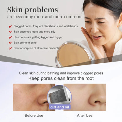 Skin Scrubber für Tiefenreinigung™